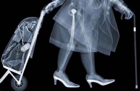 X Ray Voyeurism Nick Veasey S Images Explore What Lies Beneath PICTURES HuffPost UK