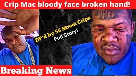 Crip Mac Explains Why He Got Bloody Face Broken Hand From 55th Street