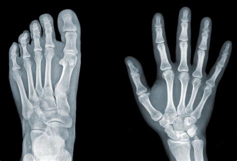 What Is The Difference Between A Ct Scan And An X Ray