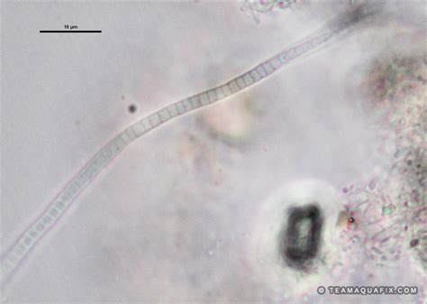 Common Wastewater Filaments Foaming And Bulking Bacteria Aquafix