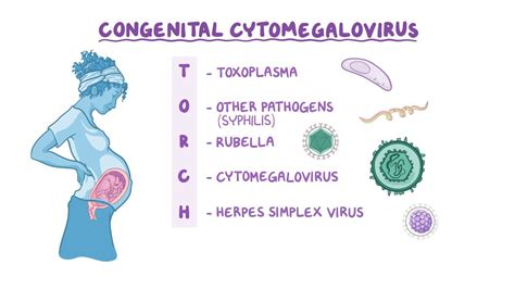 Congenital Cytomegalovirus Nord Video And Anatomy Osmosis