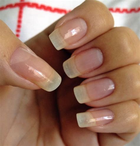 Essential Vitamins And Herbs To Grow Long Nails Naturally With Images