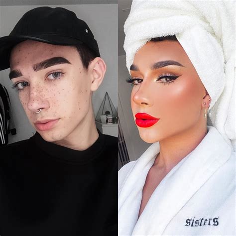 James Charles Plastic Surgery Youtuber Reveals Procedures Life And Style