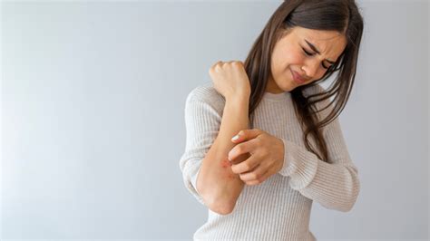 The Complex Science Behind Itch In Atopic Dermatitis National Eczema