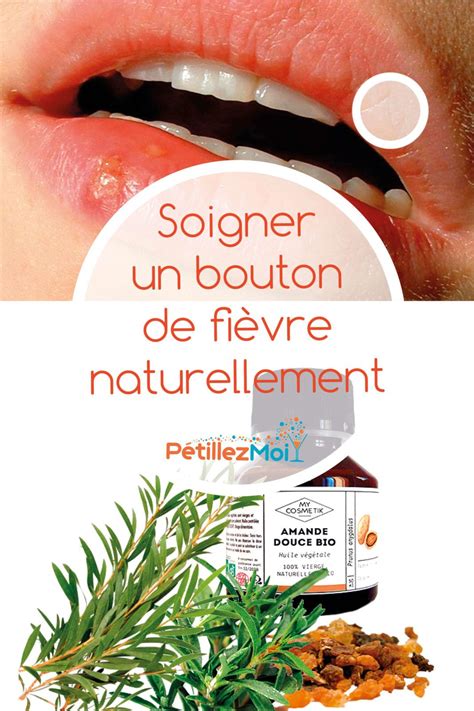 Comment Soigner Un Bouton De Fièvre Naturellement Et Rapidement En 2020