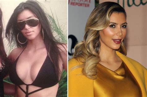 Kim Kardashian Sparks Cosmetic Surgery Rumous With Throwback Photo
