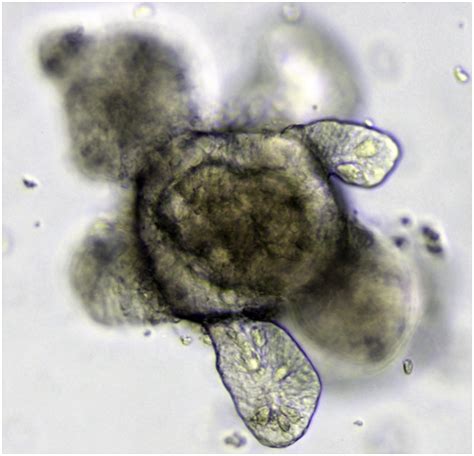 Organoid And Stem Cell Facts With Potential Medical Uses Owlcation