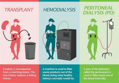 Peritoneal Dialysis Dialysis Dialysis Nurse