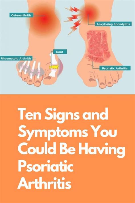 Do Not Wait For The Initial Signs And Symptoms Of Psoriatic Arthritis