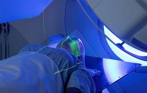 Types Of Radiation Therapy Used For Head And Neck Cancers