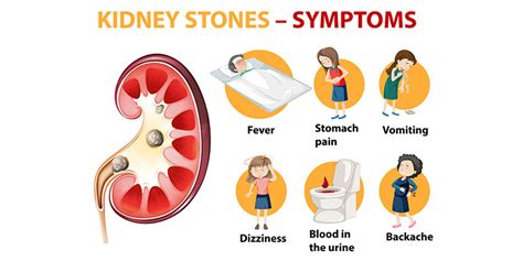 What Are Early Signs Of Kidney Stones