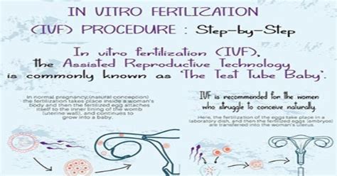 In Vitro Fertilization Ivf Procedure Step By Step Infographic