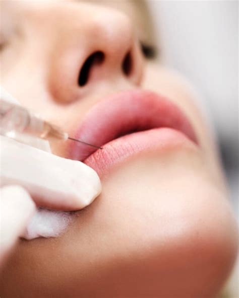 Spa And Clinic April 2019 Top 11 Tips For Natural Lip Fillers Best