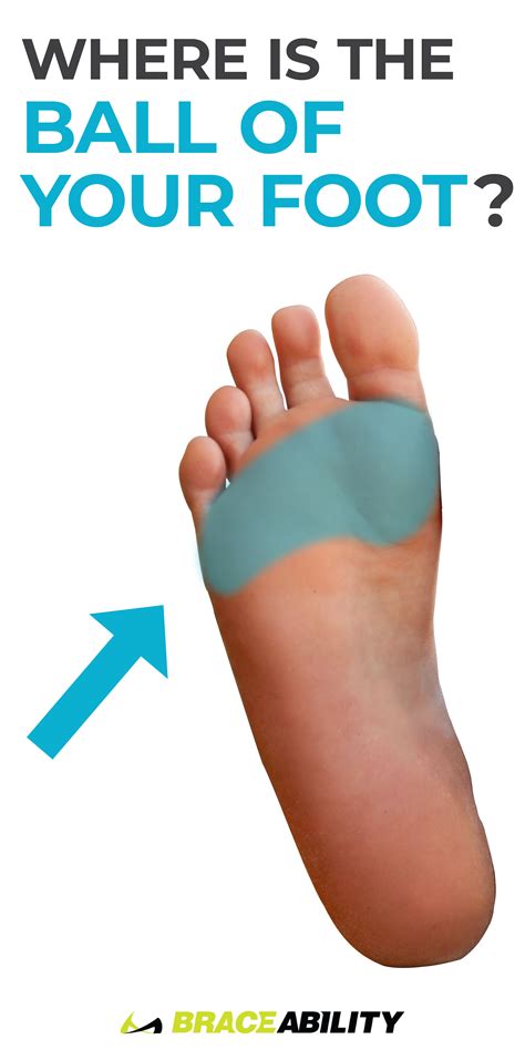 Pin On Foot And Toe Injuries Fractures Sprains Arch Pain Plantar