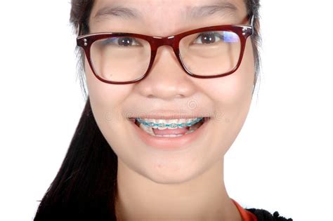 Portrait Of Asian Young Girl With Glasses And Braces Stock Image