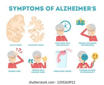 Alzheimer Disease Symptoms Infographic Memory Loss Stock Vector Royalty Free