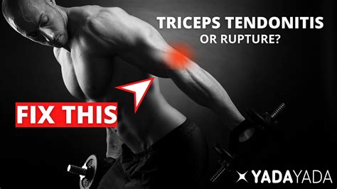 Triceps Tendonitis Or Rupture Signs Symptoms And Treatment Options