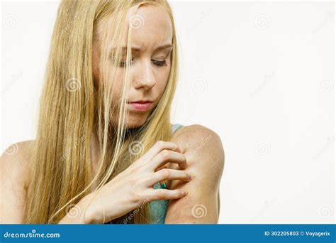 Woman Scratching Her Itchy Arm Skin Allergy Stock Image Image Of