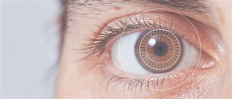 Refractive Surgery An Optometrists Personal Account Eye Care Blog