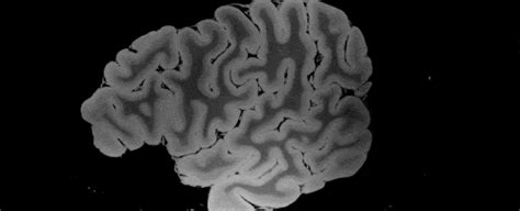 100 Hour Long Mri Of Human Brain Produces Most Detailed 3d Images Yet