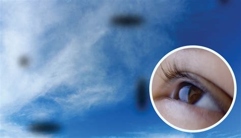 5 Things To Know About The Floaters In Your Eyes This Quarterly