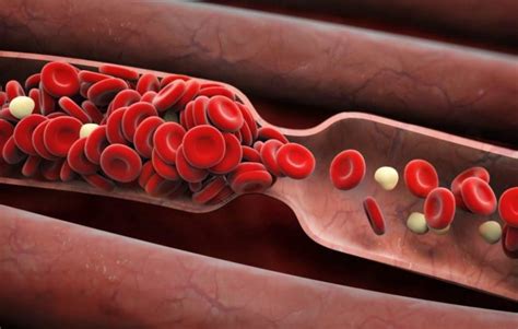 Here Are 8 Warning Signs Of A Blood Clot That You Cant Ignore