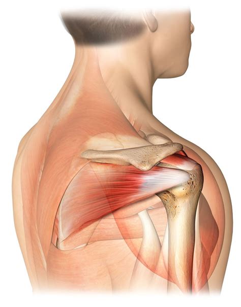 One of a principal characteristic of tendonitis is a particular pain, but in some cases, a checkup of a zone of injured tendon identifies additional symptoms of the damage. Rotator Cuff Tears Diagnosis, Symptoms, and Treatment