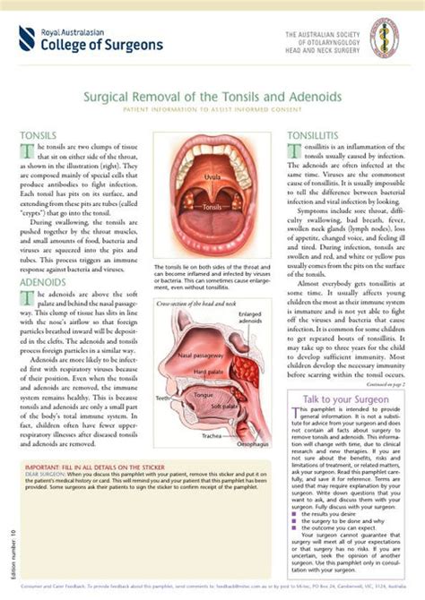 Surgical Removal Of The Tonsils And Adenoids Mi Tec Medical Publishing