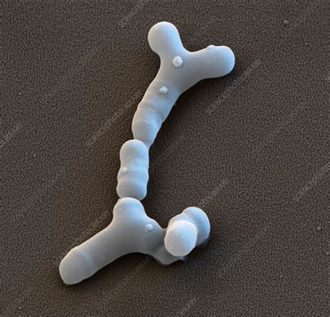 Bifidobacterium Bacteria Sem Stock Image C0357895 Science Photo