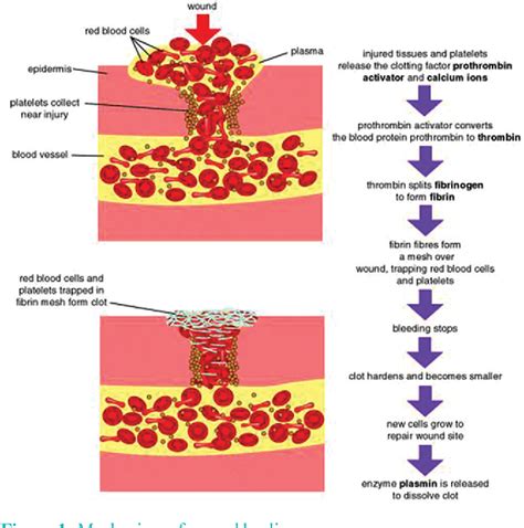 How Does A Blood Clot Look Blood Clot Symptoms Causes And Treatment