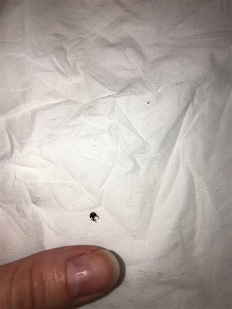 Please Help—is This A Bed Bug Found Dead On Pillow But No Other Signs