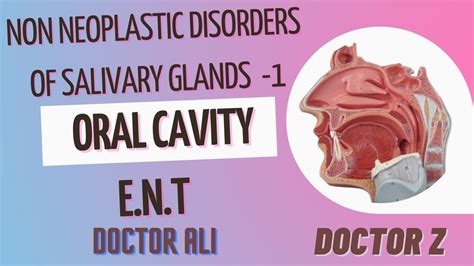 Non Neoplastic Disorders Of Salivary Glands 1 Ent Dr Ali Doctor