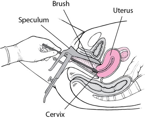 Which Examination Position Is Used For Gynecologic Examinations