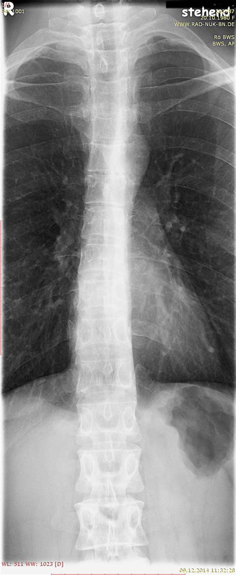 Röntgen Thorax 3 Doccheck