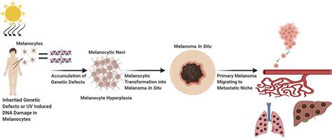 Melanoma Tamaryneashley