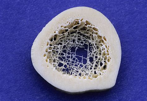 Real Cross Section Of A Bone Bone Wikipedia This Page Discusses The