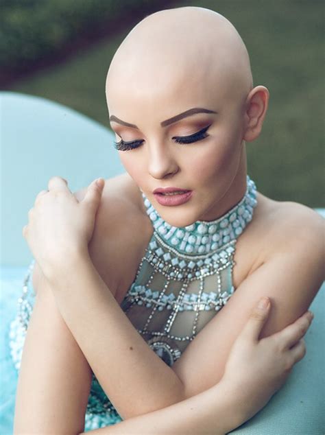 bald teen goes viral uses glamorous photoshoot to spread riveting message about beauty