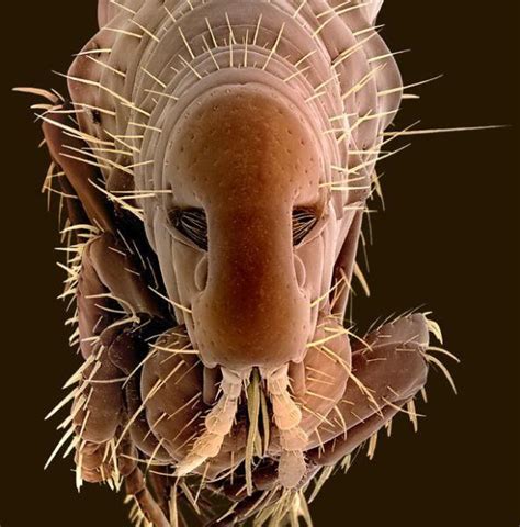 Leech helobdella stagnalis under a microscope, family glossiphoniidae, order rhynchobdellida. Parasites under the microscope