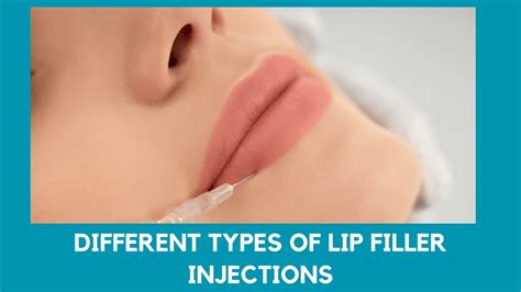 Ppt Different Types Of Lip Filler Injections Powerpoint Presentation