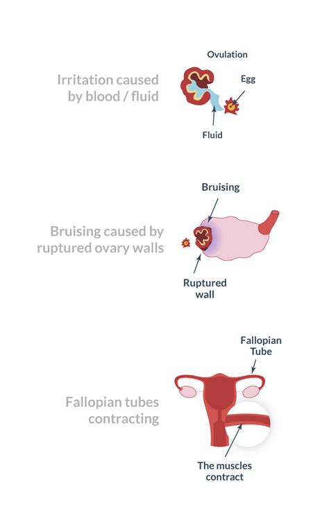Difference Between Ovulation Pain And Appendicitis
