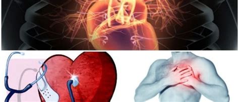 Insuficiencia Cardíaca Definición Causas Síntomas Diagnóstico