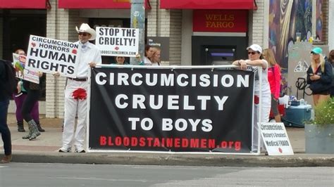 Whats Behind Declining Circumcision Rates Texas Standard