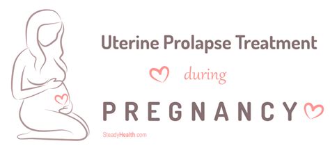 Uterine Prolapse Treatment During Pregnancy Pregnancy Articles