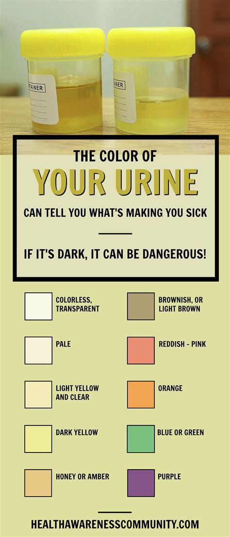 Here S What The Color Of Your Urine Says About Your Health With Images Urinal Color Health