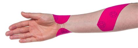 Kt Tape Wrist Tendonitis Tennis Elbow ⋆ Santa Barbara Deep Tissue