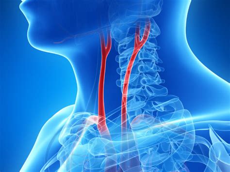 Lower Income Linked To Higher Odds Of Clogged Neck Arteries American