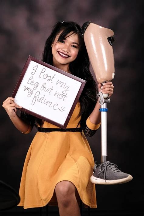 Look Isabela Student Proudly Holds Prosthetic Leg In Creative