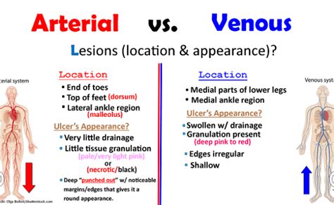 Peripheral Arterial Disease Vs Peripheral Venous Disease Pad And Pvd