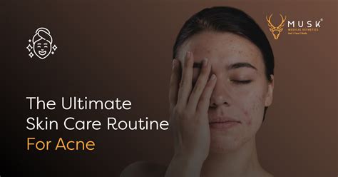 The Ultimate Skin Care Routine For Acne