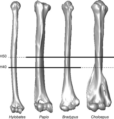 The humerus is the long bone located in the upper arm of the body which extends from the shoulder joint to the elbow. Humeral Cross‐Sectional Shape in Suspensory Primates and Sloths - Patel - 2013 - The Anatomical ...
